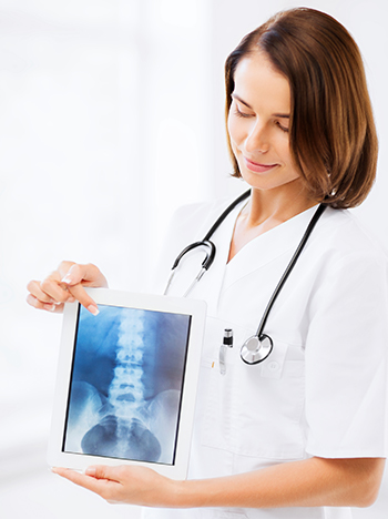 Female doctor holding an x-ray of a spinal cord